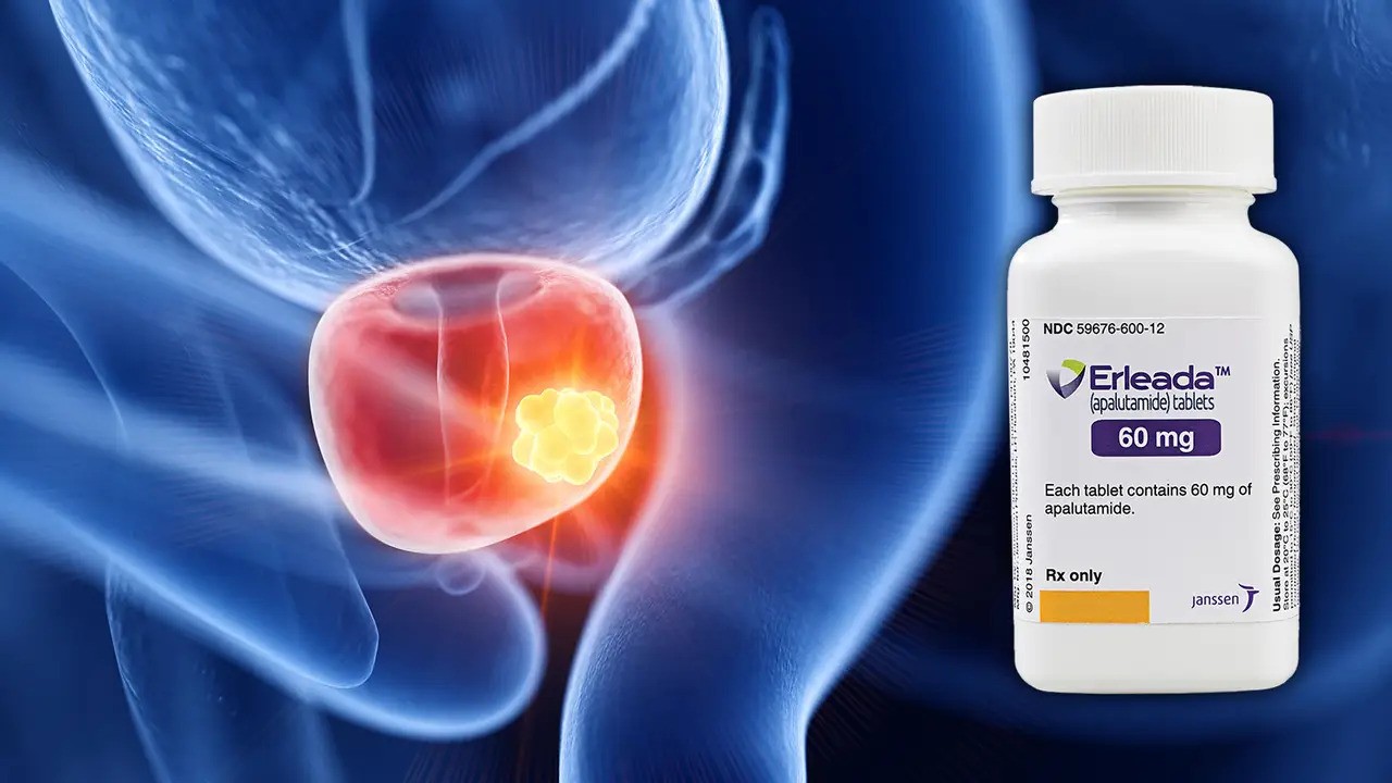 Johnson & Johnson-ийн шинэ эмчилгээ хорт хавдрын нас баралтыг 51 хувиар бууруулдаг нь батлагдав