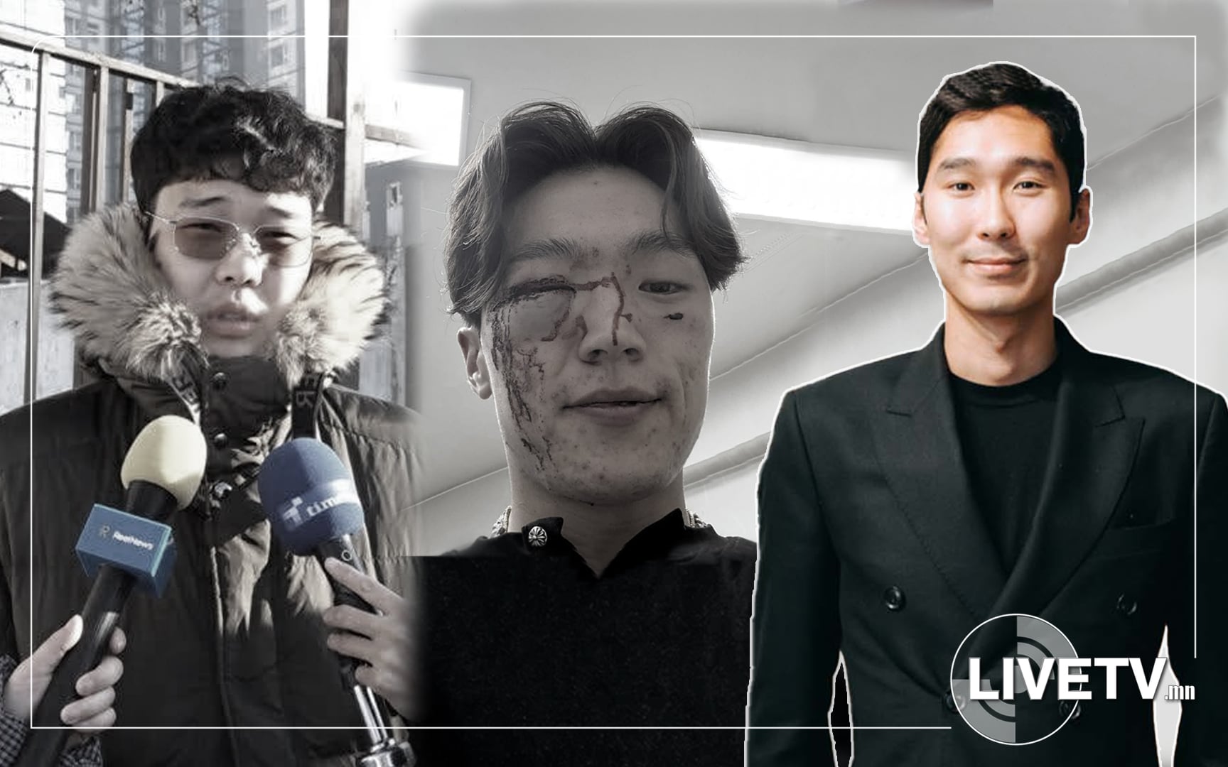 Хохирогчийн аав Л.Сүмбанд: Б.Амарсайхан нь өөрөө харж зогсоод, хамт явж байсан 3-4 залууг өдөөн турхирч явуулаад миний хүүг зодуулсан