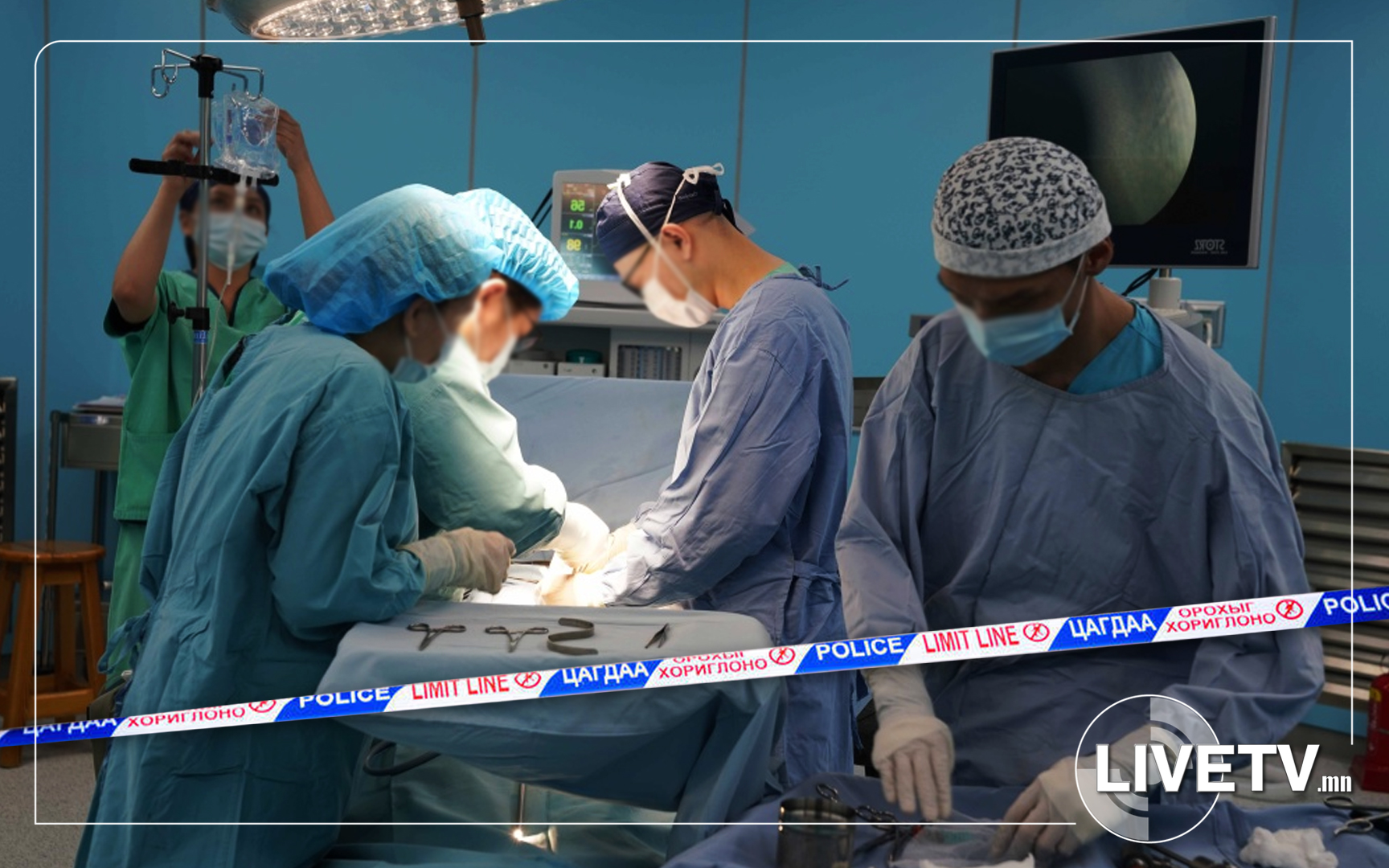 Тусгай зөвшөөрөлгүй оюутан мэс засал хийж, үйлчлүүлэгч амиа алджээ