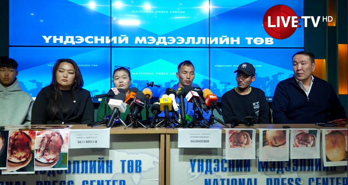 🔴Г.Ганхуяг: Баавгайн халдлагад өртсөн эмэгтэйн бие маш хүнд байна, анчдад квот олгож зэрлэг араатныг зохицуулах хэрэгтэй
